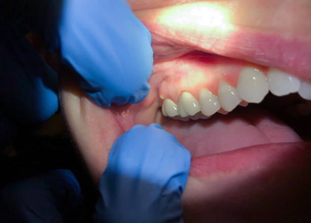 Best Mobile Emergency Dentist in Parker, SC